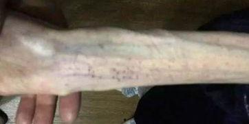 一位少女吃瓜摔倒哭了视频,吃瓜需谨慎